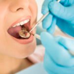 What Are The Main Considerations For Choosing An Emergency Dentist?